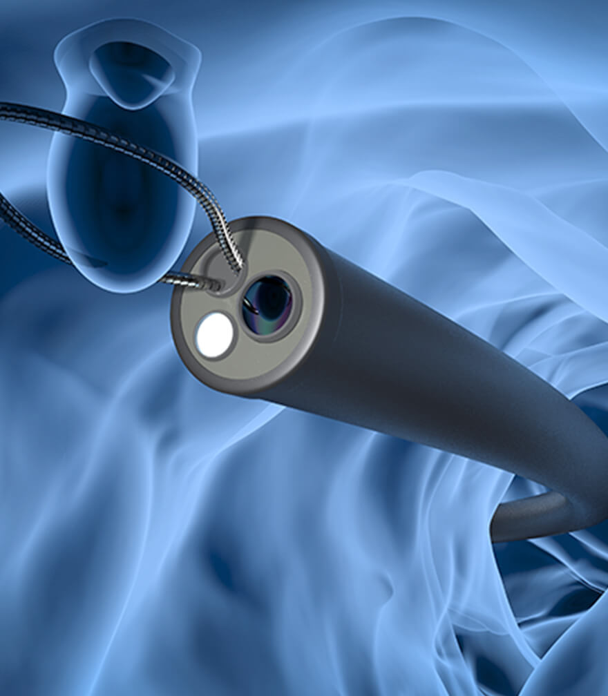 内視鏡専門医による検査・日帰りポリープ切除